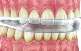 Articulación témporo-mandibular 1
