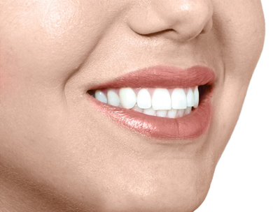 Tratamiento Invisalign 3