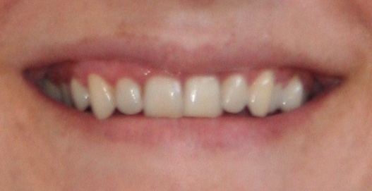 Diseño interdisciplinar de sonrisa